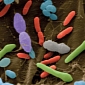 Study Links Obesity to Microorganisms in the Gut