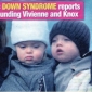 Tab: Angelina Jolie and Brad Pitt’s Twins May Have Down Syndrome