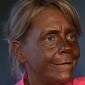 “Tan Mom” Patricia Krentcil Emerges, Looks Somewhat Different Because of Botox - Gallery