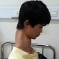 Teen Nicknamed “Giraffe Boy” Has an Abnormally Long Neck