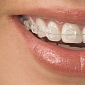 The New Trend in Japan Is Making Your Teeth Look Crooked