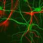 The Protein Which Keeps the Synapses Working