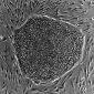 Tissue Regeneration Possible with Stem Cells from Body Fat