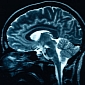 Transcranial Magnetic Stimulation Can Minimize Forgetfulness