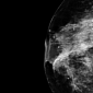Triple Negative Breast Cancer Genome Decoded