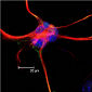 Turning Astroglia into Neurons Now Possible