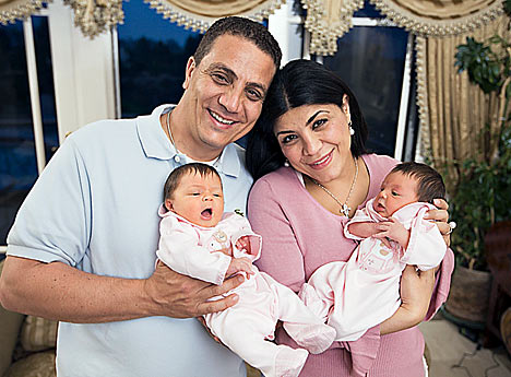 twins mothers different born rare twiniversity definition types birth bizarre twin listverse