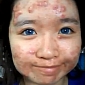 Viral of the Day: Teen Elaine Mokk’s Acne Coverage Foundation Routine
