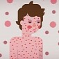 Watch: Everything You Ever Wanted to Know About Measles