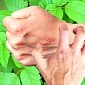 Watch: How and Why Poison Ivy Causes Insufferable Rashes