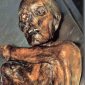 Why Did Ötzi, the 'Iceman' Mummy, Die?