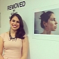 Woman Compulsively Damaging Her Skin Reveals Scars in Public Exhibition
