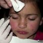 Woman Gives 8-Year-Old Daughter Botox Injections