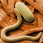 Worms Hold the Key to Slowing the Aging Process