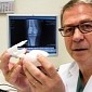 X-Rays Become Guides for Knee Replacement Surgeries Thanks to 3D Printing