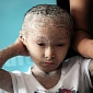 Young Boy Suffers from Condition Giving Him Fish Skin, Scales