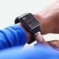 Apple Watch Could Detect Hyperkalemia with AliveCor's KardiaBand, Study Finds