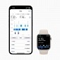 Apple Watch Is Finally Getting Proper Sleep Tracking