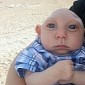 Baby Boy Born with Only Half a Skull Says “Hello” - Video