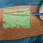 Here's a Useful Medical Device That Shows a Patient's Veins