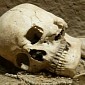 Scientists: Big Holes in the Skull Are a Sign of Intelligence