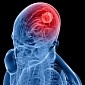 Scientists Figure Out How to Slow the Growth of Deadly Brain Tumor
