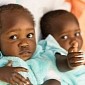 Surgeons Successfully Separate 11-Month-Old Conjoined Twins