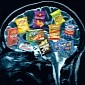 The Brains of Obese Individuals Respond Differently to Food