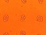 Pictured is dynamic patterning of bovine red blood cells (diameter of 5.8 micrometers) through "acoustic tweezers" technology