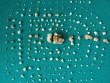 Teeth pulled from the 7-year-old girl's mouth