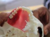 3D printed jaw section