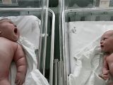 Nadia compared to another baby in the hospital