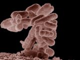 O157:H7, a wily bacteria