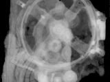 An X-ray image of the Antikythera mechanism