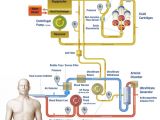 Graphic details how the artificial liver system works