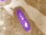 Listeria usually lives in soil and water