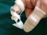 The Origami Finger prosthetic