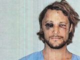 Olivier Martinez ruined Gabriel Aubry’s model face in Thanksgiving 2012 beating