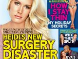 Heidi Montag regrets plastic surgery, shows off her horrible scars