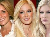 Heidi Montag before and after turning herself into a real-life Barbie doll