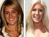 Heidi Montag says she regrets her surgical transformation
