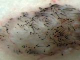 Photo shows hair grown in the lab