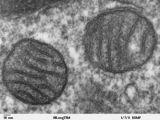 Transmission electron microscope image of a thin section cut through an area of mammalian lung tissue. The high magnification image shows a mitochondria