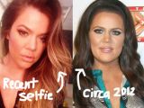 Khloe Kardashian’s lips went from big to bigger in a very short time