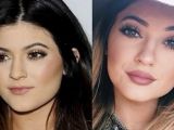 Kylie Jenner before and after the alleged plastic surgery and the fillers