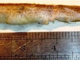 This is the eel that was recovered from the boy's throat