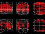 Grey matter loss (red) in people who never meditate (top row) and people who do (bottom row)
