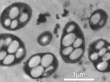 Transmission electron micrograph image of GFAJ-1
