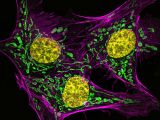 Bovine pulmonary artery endothelial cells stained for actin (pink), mitochondria (green) and DNA (yellow)