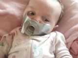 Another photo shows the infant with duct tape on her face